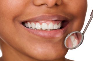 close up cropped image of woman smiling with a dental mirror near her mouth white spots dental concern oral health dentist in Chapel Hill North Carolina