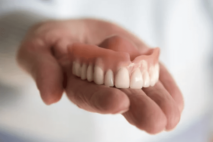 Why Dentures Must Be Moist