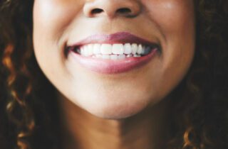 TOOTH BONDING in Chapel Hill, NC can help reshape your teeth and improve your smile.