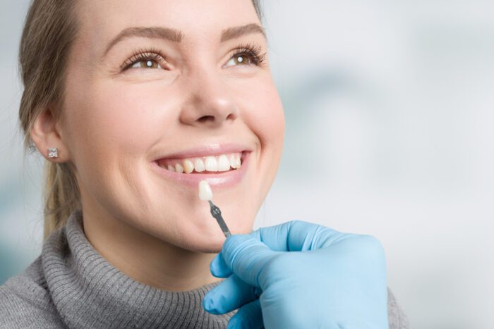 PORCELAIN VENEERS in CHAPEL HILL NC can help many patients improve their smile