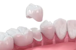 Whether you're dealing with tooth pain or recovery after a procedure, a dental crown could provide the protection your tooth needs.