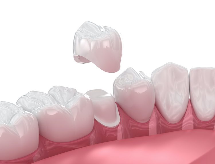 Whether you're dealing with tooth pain or recovery after a procedure, a dental crown could provide the protection your tooth needs.