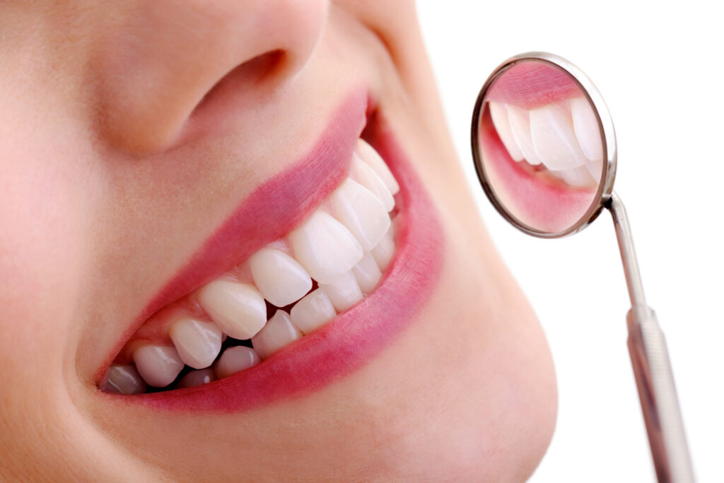 Professional Teeth Whitening vs. At-Home Kits in Chapel Hill